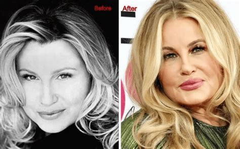 Truth Behind Jennifer Coolidge’s Plastic Surgery Rumors